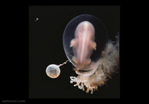 9-embryo-6weeks-photo-by-lennart-nilsson